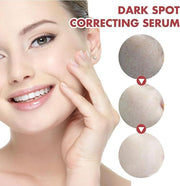 Niacinamida Serum 10% para Manchas