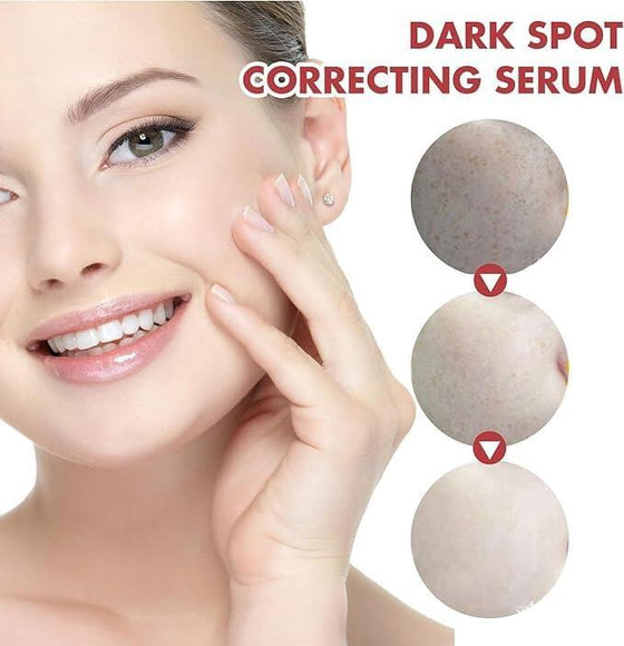 Niacinamida Serum 10% para Manchas