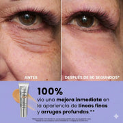 Gel tensor rejuvenecedor de ojos rápido