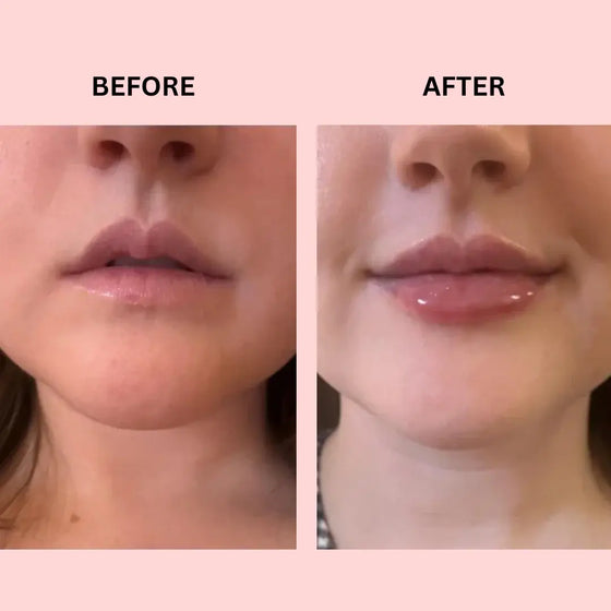 Lipboost reafirmante labios natural