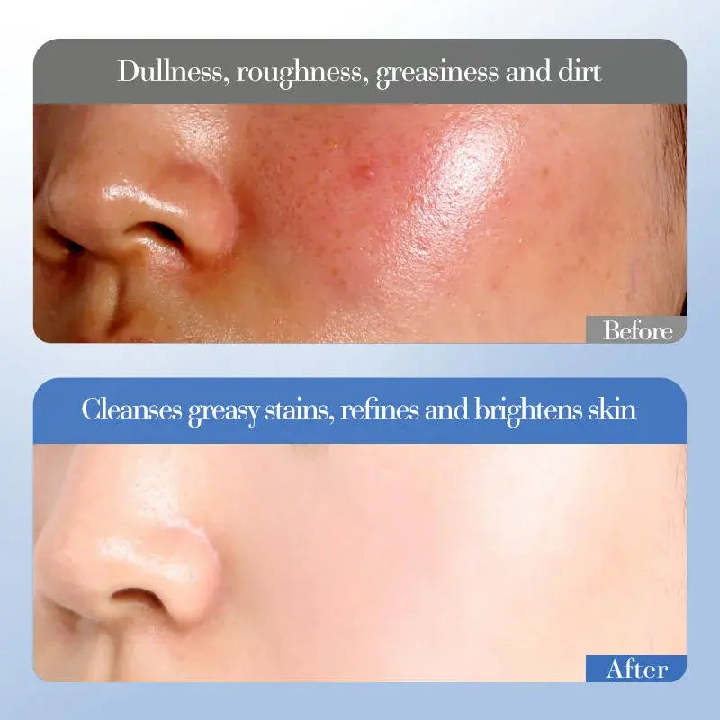 Crema facial niacinamida y arroz