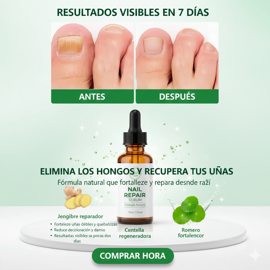Spray antihongos para uñas natural