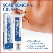 Crema para cicatrices JAYSUING 30GR