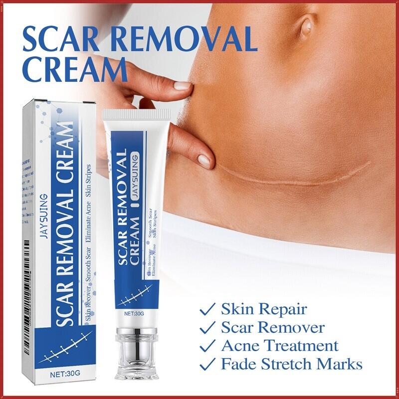 Crema para cicatrices JAYSUING 30GR