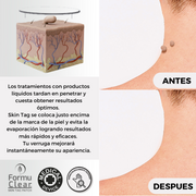 Parches para verrugas sin dolor