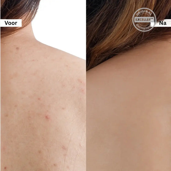 Crema reafirmante poros sal rosa facial