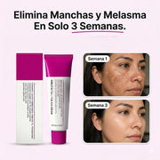 Crema Arbutina para manchas faciales
