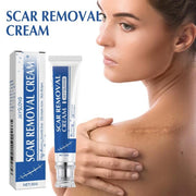 Crema para cicatrices JAYSUING 30GR